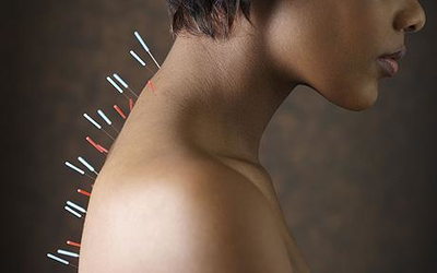 Zwanger worden bevorderen met acupunctuur? Veilig en pijnloos bij Acupuncturisten Overzicht!